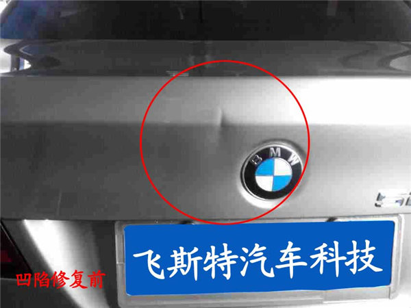 凹陷修復(fù)修復(fù)前