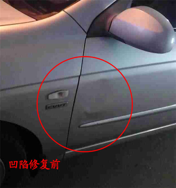 凹陷修復(fù)修復(fù)前